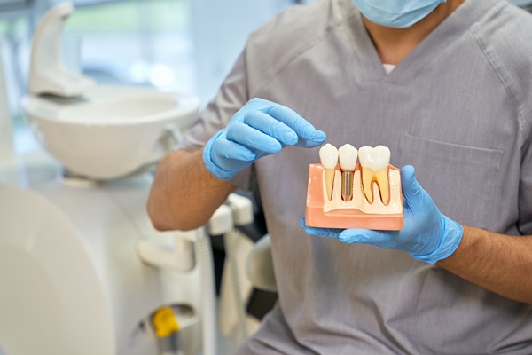 How Dental Implants Slow Down And Prevent Bone Loss