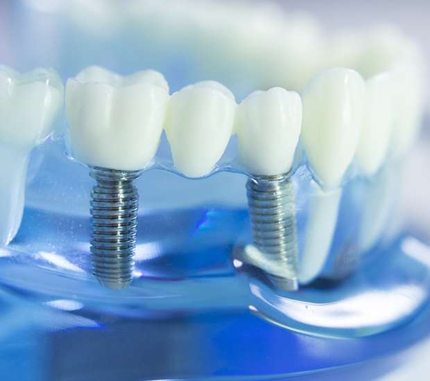 Rowley Dental Implants