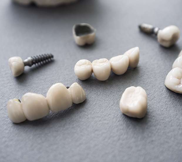 Rowley The Difference Between Dental Implants and Mini Dental Implants